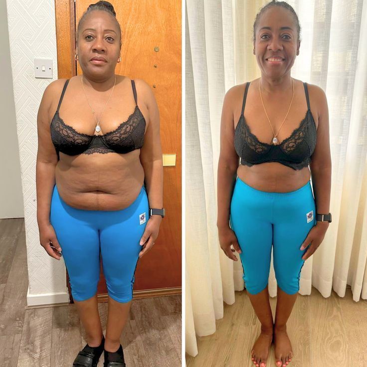 Antes e depois 1
